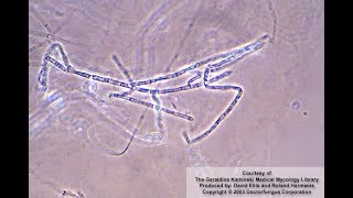 Microsporum ferrugineum identification [upl. by Dell853]