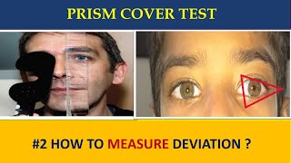 PRISM COVER TEST  everything you need to know [upl. by Alleul537]