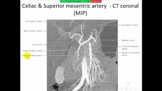 Radiological anatomy course frcr Abdomen 2  Arabic edition [upl. by Intosh]