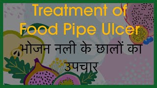 Treatment of Food Pipe Ulcer  How to Treat Ulcer  ulcer ulcertreatment [upl. by Ardeahp965]