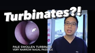 Inferior Turbinates what are they why do they swell stuffy nose congestion how do we treat [upl. by Marybeth]