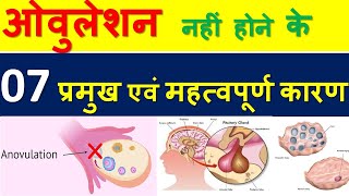 ओवुलेशन नहीं होने के 7 प्रमुख एवं महत्वपूर्ण कारण  REASON FOR NO OVULATION  ANOVULATION IN HINDI [upl. by Aneel367]