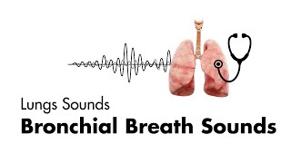 Bronchial Breath Sounds  Lung Sounds  Medzcool [upl. by Aerdnaeel]