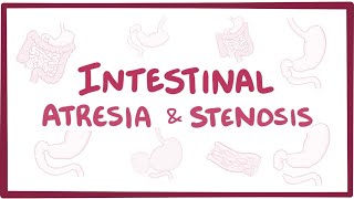 Intestinal atresia amp stenosis  an Osmosis Preview [upl. by Merras]