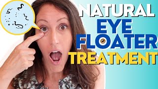 Natural Eye Floater Treatment  4 Ways to Treat Eye Floaters [upl. by Kalvin735]