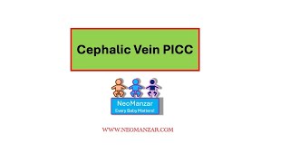 Cephalic Vein PICC Arm movement [upl. by Nnagrom]