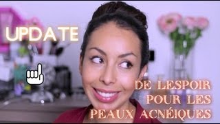 Update Routine Visage suite de ma lutte contre lacné [upl. by Okir893]