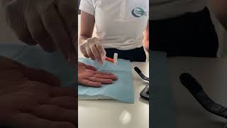 STIMOLAZIONE NEUROLOGICA PER RIABILITAZIONE DELLA MANO CON ERGOTERAPISTA [upl. by Nader]