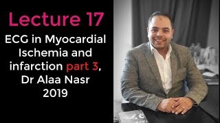 ECG from A to Z 017Alaa nasr2019 Myocardial ischemia part 3 [upl. by Enorel]