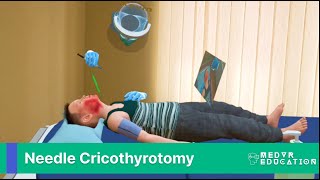 Needle Cricothyrotomy in Virtual Reality and Mixed Reality [upl. by Llerrom]