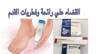 التخلص من رائحة القدم الكريهة والفطريات [upl. by Whetstone239]