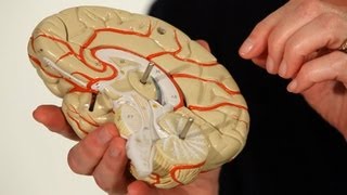 Surgical Options for Epilepsy  Epilepsy [upl. by Ly]