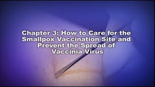 Chapter 1 Smallpox Vaccination with ACAM2000 Introduction [upl. by Akimal]