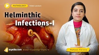 Helminthic Infections  Pathology Course  Medical Education  VLearning  sqadiacom [upl. by Ydasahc100]