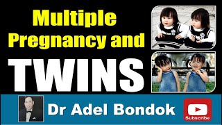 Types of Twins Identical and Fraternal Dr Adel Bondok [upl. by Dorena]