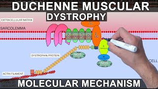 Duchenne Muscular Dystrophy [upl. by Jahdai]