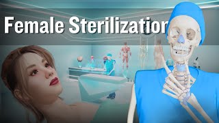 Female Sterilization Tubal Ligation Procedure  Tubectomy 3D Animation [upl. by Ettenad]