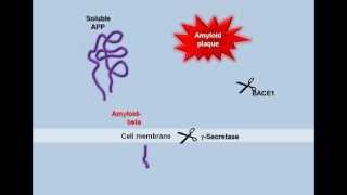 Plaque Formation in the Alzheimers Brain [upl. by Euginom]