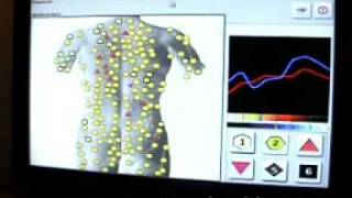 METATRON NONLINEAR BODY SCANNING TECHNOLOGY [upl. by Boylston341]