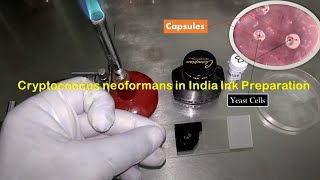 India Ink Preparation Procedure and observation of Crpytococcus neoformans capsules in CSF [upl. by Koppel127]