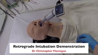 Retrograde Intubation Demonstration [upl. by Eniamzaj]