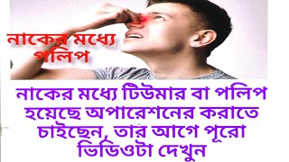 Discussion of Nasal Polypনাকের পলিপ বা টিউমারits causesDiagnosisHomeopathy treatmentManagement [upl. by Arne451]