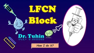 Lateral Femoral Cutaneous Nerve Block  Ultrasound  Loss of Resistance  LFCN Block [upl. by Aryas41]