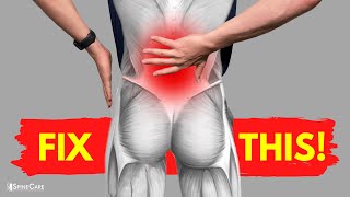 How to Fix Lower Back Strain Pain in 30 SECONDS [upl. by Deirdra]