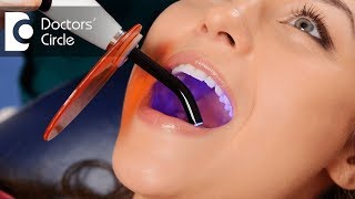 What are dental fillings made of Dr Abhishek Bhadranna [upl. by Paderna149]