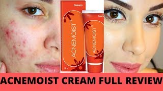 ACNEMOIST CREAM FULL REVIEW BEST CREAM FOR ACNE PRONE SKIN पिम्पल्स वाले लोगो के लिए बेस्ट क्रीम [upl. by Carin]