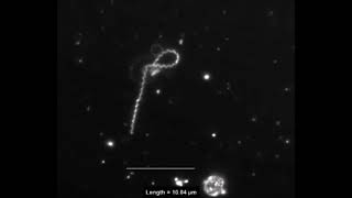 Interaction of Treponema pallidum the syphilis spirochete with human platelets [upl. by Andra]