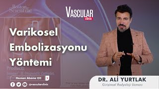 Varikosel Embolizasyonu Yöntemi  Girişimsel Radyoloji Uzmanı Ali Yurtlak [upl. by Ettenowtna]