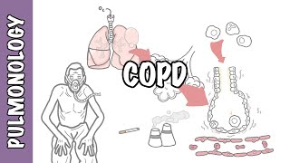 Understanding COPD  Chronic obstructive pulmonary disease cause pathophysiology and treatment [upl. by Sallie]