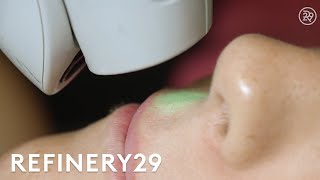 I Got Laser Hair Removal For The First Time  Macro Beauty  Refinery29 [upl. by Tedmund]