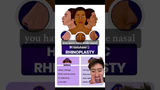 What is ethnic rhinoplasty [upl. by Yeleak]