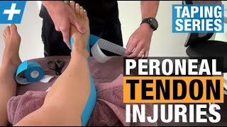 How to Tape for Peroneal Tendon Injuries [upl. by Raynell993]