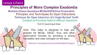 Lecture 4 Part4 MCQs  Open Extraction of Single Rooted Tooth  OSCE  VIVA [upl. by Mosa]