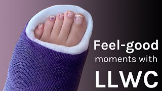 Feelgood Momente mit LLWC Gipsbein long leg cast toe plate [upl. by Aivun635]