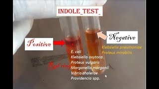 Indole test positive Indole test enterobacteria practical microbiology [upl. by Masson]