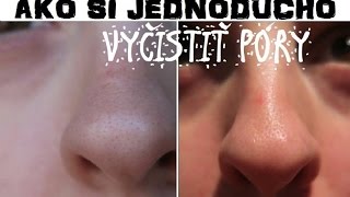 Jednoduchý návod ako si vyčistiť póry  DIY pore strip [upl. by Robinett464]