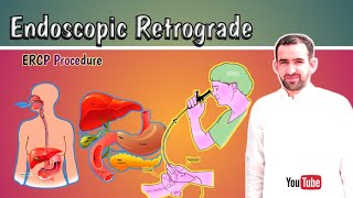 Endoscopic Retrograde Cholangiopancreato GraphyERCP Procedure explained [upl. by Tareyn]