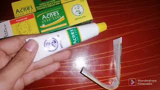 review on acnes scar care  best cream for dark spots [upl. by Notpmah]