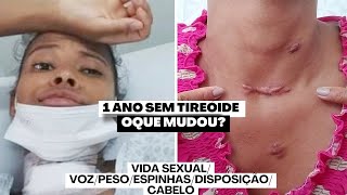 COMO É VIVER SEM TIREOIDE   1 ANO DE TIREOIDECTOMIA  CÂNCER NA TIREOIDE [upl. by Perkin504]