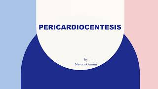 PERICARDIOCENTESIS [upl. by Jackelyn647]