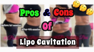 Lipo Cavitation  Laser Lipo  Pros amp Cons  Ep 4 [upl. by Ihskaneem]