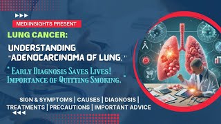 Understanding Adenocarcinoma of Lung Symptoms Causes Diagnosis and Treatments  MediInsights [upl. by Nosreh]