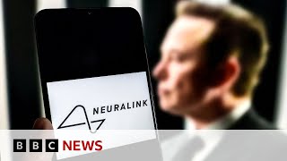 Elon Musk announces first Neuralink wireless brain chip implant in a human  BBC News [upl. by John]