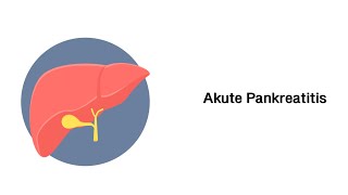 Akute Bauchspeicheldrüsenentzündung Akute Pankreatitis [upl. by Pierpont]