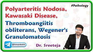 2 Polyarteritis Nodosa Kawasaki Disease Thromboangiitis obliterans Wegeners Granulomatosis [upl. by Elocan4]