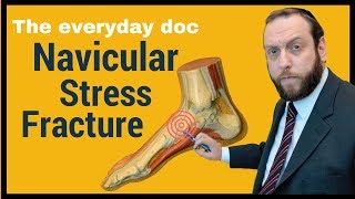 NAVICULAR STRESS FRACTURE THE EVERYDAY DOC [upl. by Sieber]